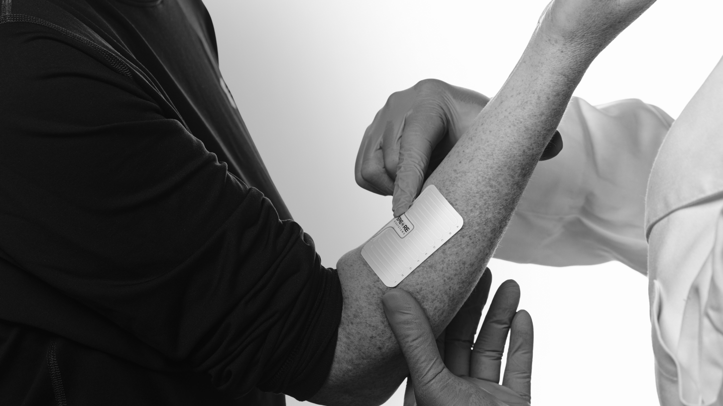 Wearable patch applied to arm for sweat analysis